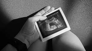 Miscarriage: What It Is, Common Facts, and How to Get Support